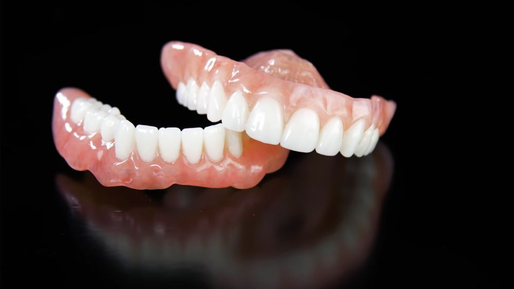 dentistatito-protesi-dentali-fisse-01