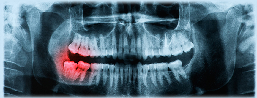 Chirurgia Orale Centro Medico Odontoiatrico A.C.O. Dental